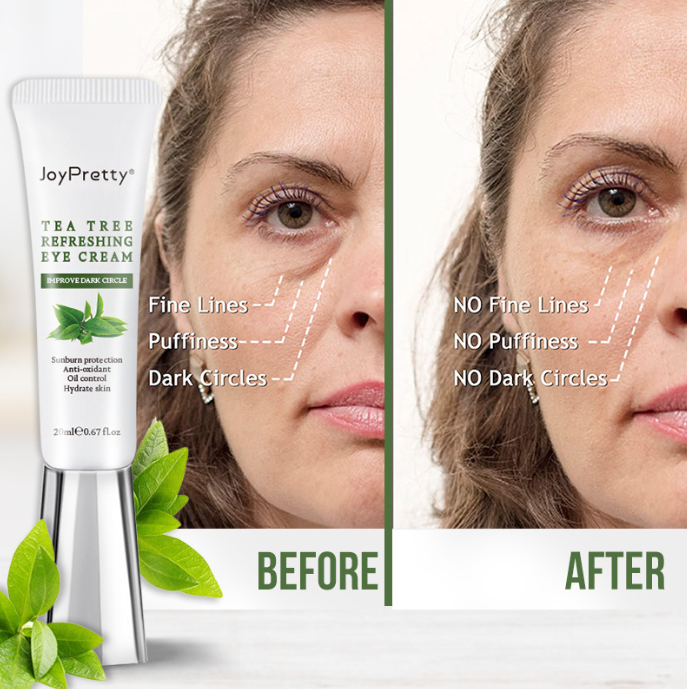 Pimple Removal Facial Skin Care for Oily Skin (One Item)